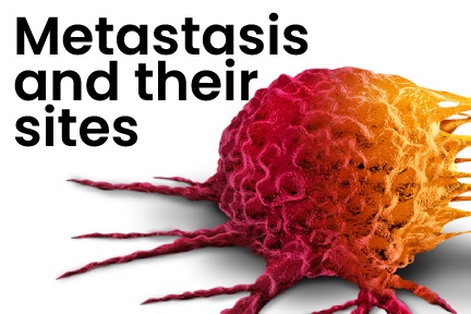 Metastasis and their sites