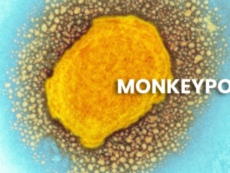 Monkeypox: What is it? And Is it a threat in 2022??