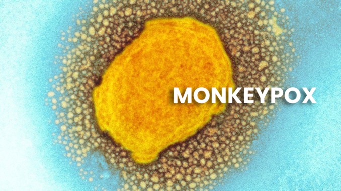 Monkeypox: What is it? And Is it a threat in 2022??